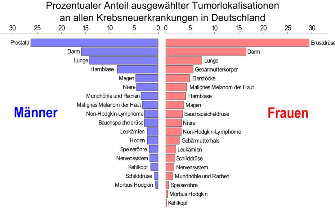 Milchprodukte erhöhen das Risiko, an Prostatakrebs zu sterben